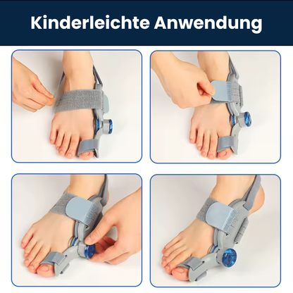 BallenFix Hallux Valgus Korrektur