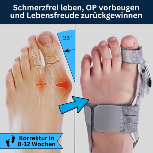 BallenFix Hallux Valgus Korrektur